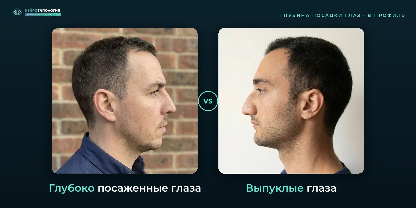 Глубоко посаженные глаза и выпуклые глаза: сравнение, фото в профиль Глубоко посаженные глаза и выпуклые глаза: сравнение, фото в профиль