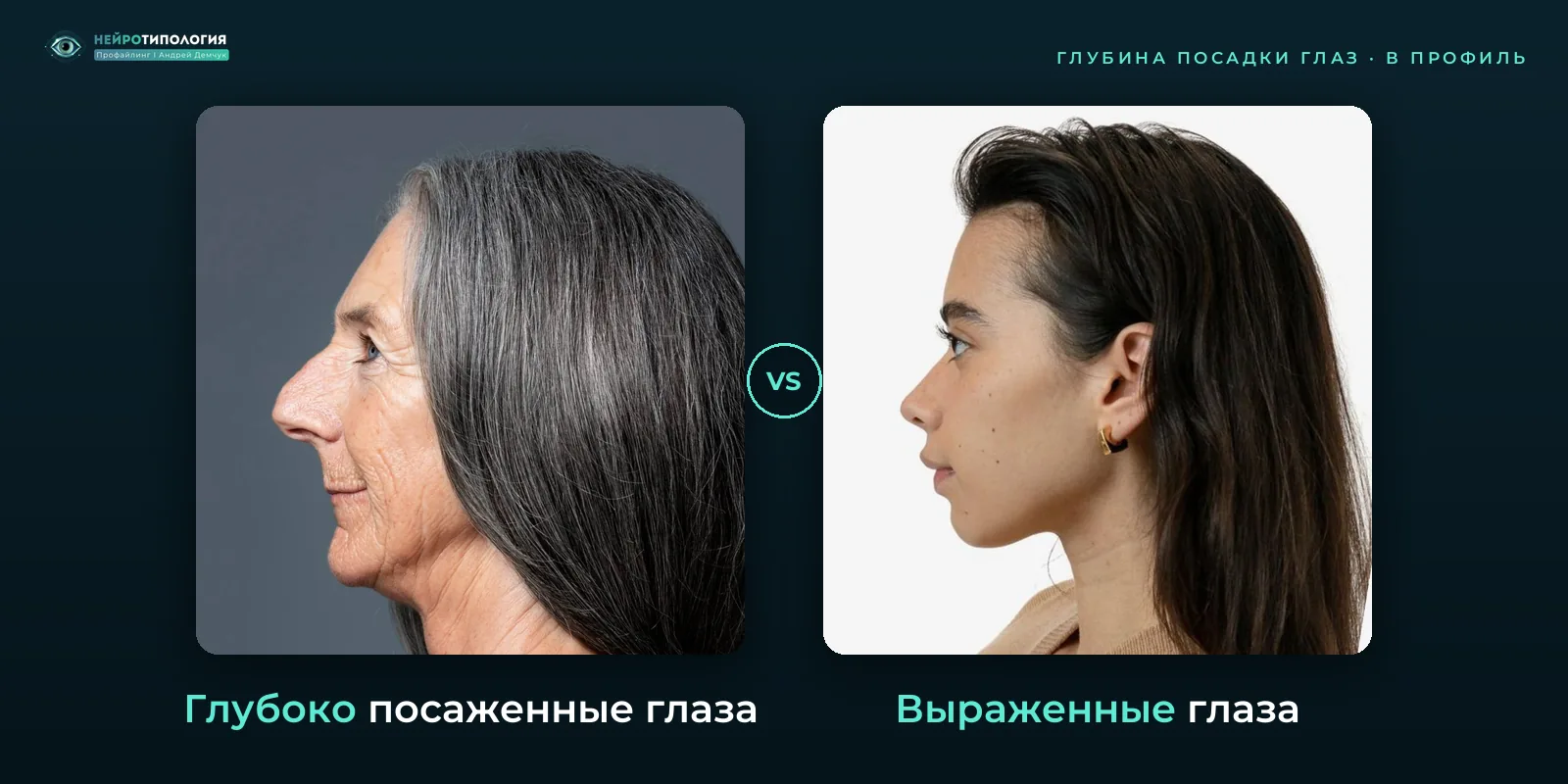 Глубоко посаженные глаза и выраженные глаза: сравнение, фото в профиль Глубоко посаженные глаза и выраженные глаза: сравнение, фото в профиль