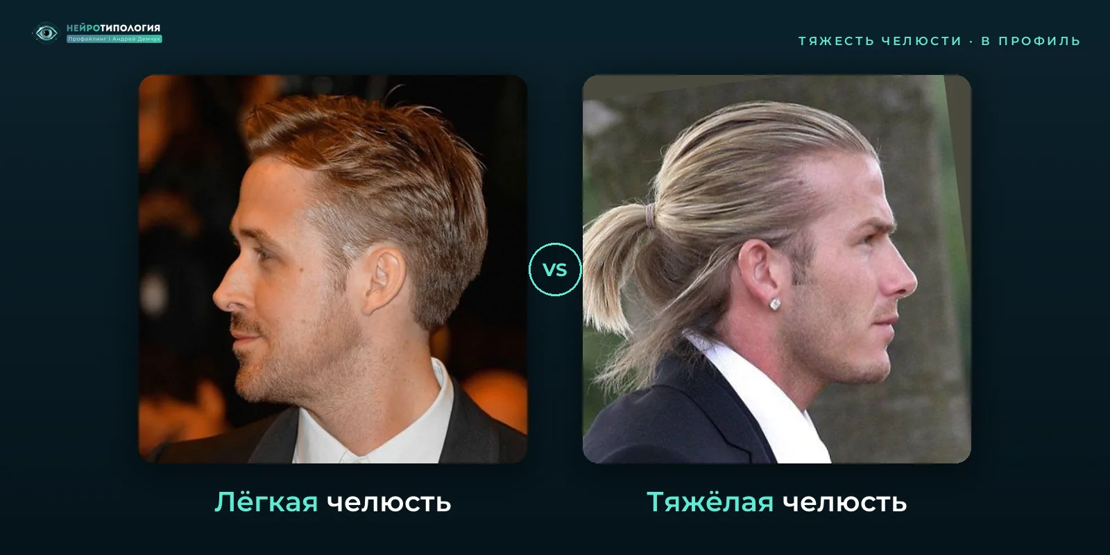 Лёгкая челюсть и тяжёлая челюсть: сравнение, фото в профиль Лёгкая челюсть и тяжёлая челюсть: сравнение, фото в профиль