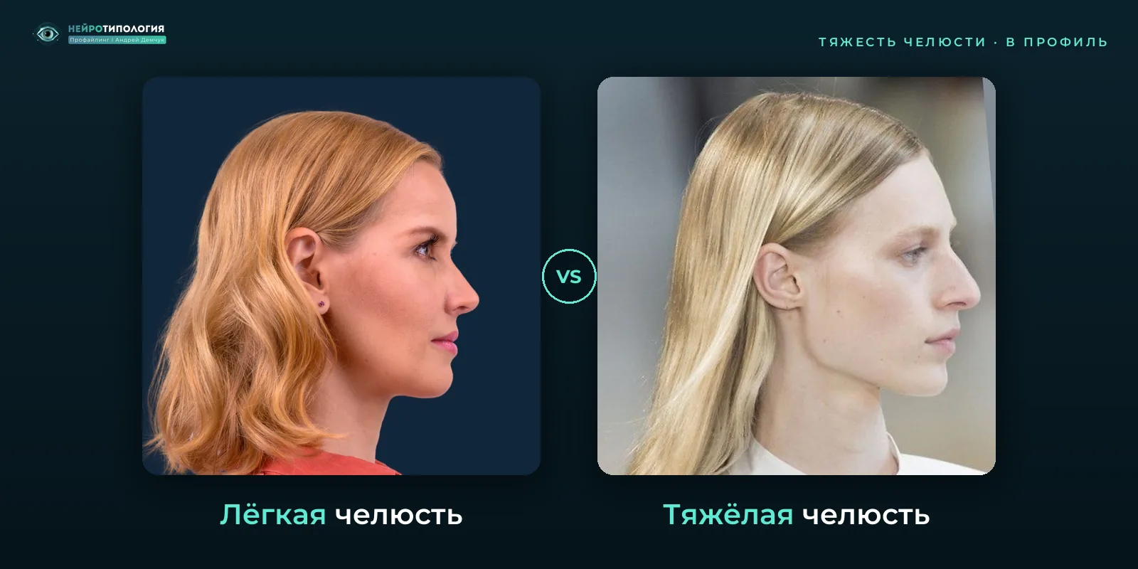 Лёгкая челюсть и тяжёлая челюсть: сравнение, фото в профиль
