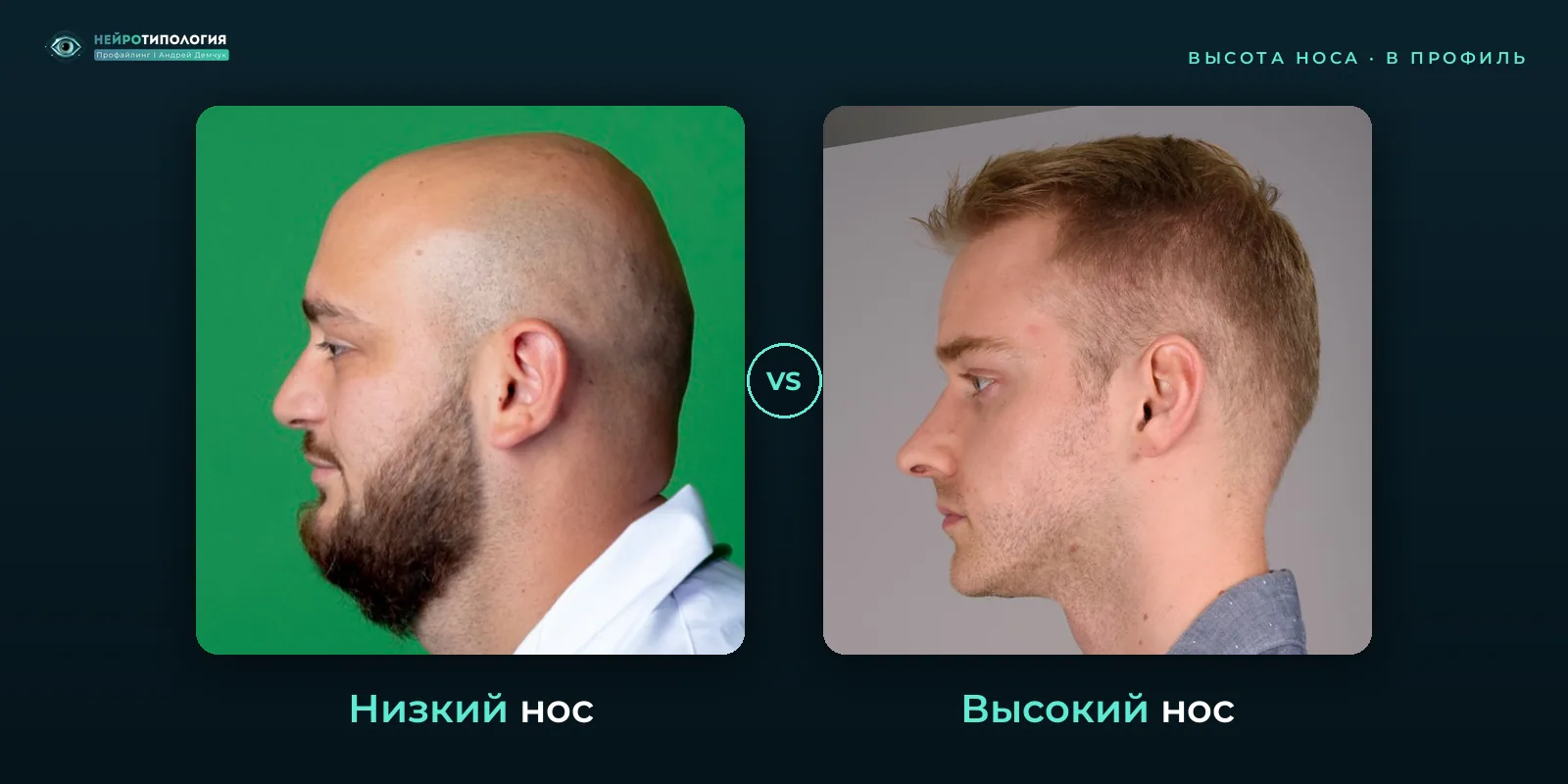 Низкий нос и высокий нос: сравнение, фото в профиль Низкий нос и высокий нос: сравнение, фото в профиль
