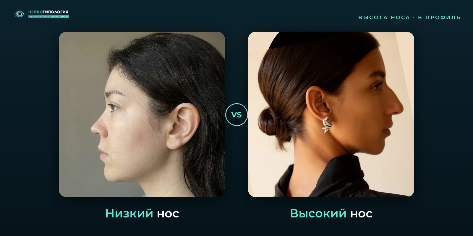 Низкий нос и высокий нос: сравнение, фото в профиль Низкий нос и высокий нос: сравнение, фото в профиль
