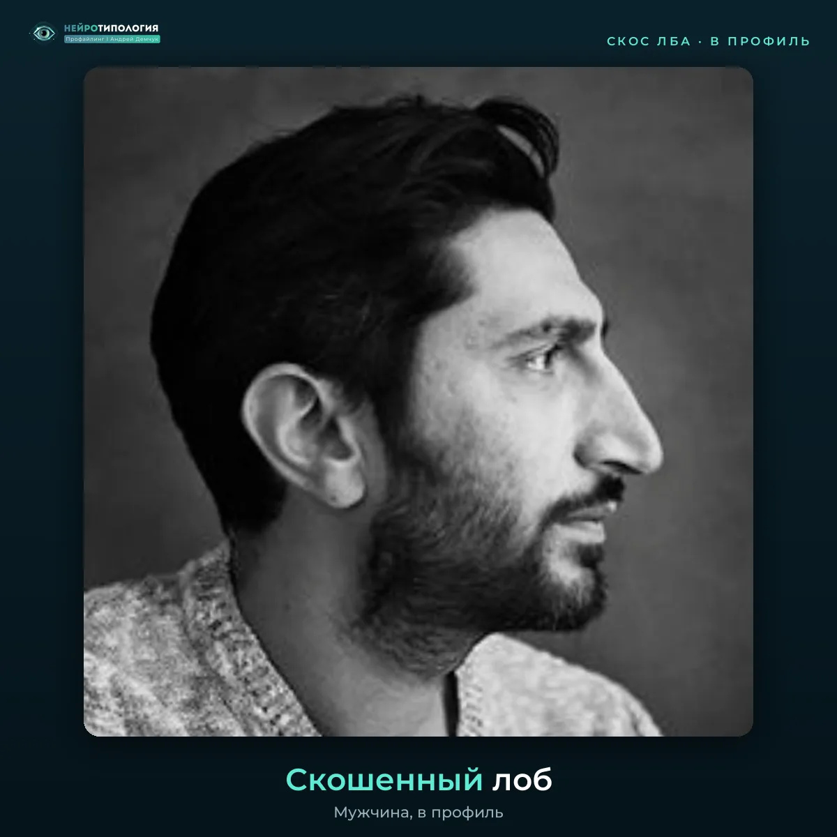 Скошенный лоб, фото в профиль Скошенный лоб, фото в профиль