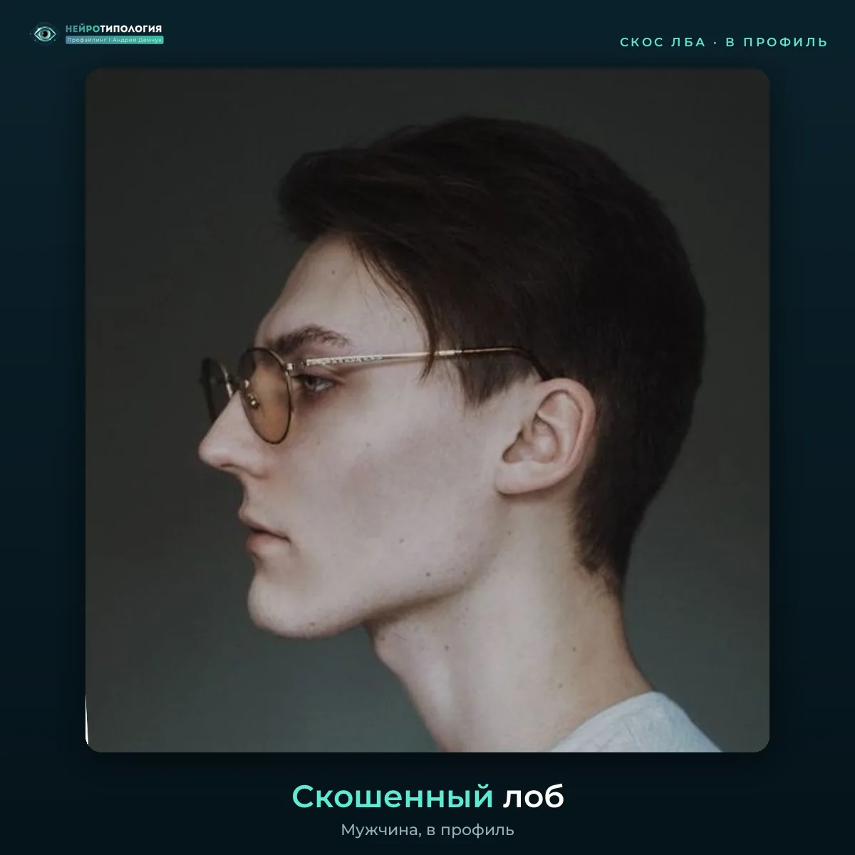 Скошенный лоб, фото в профиль