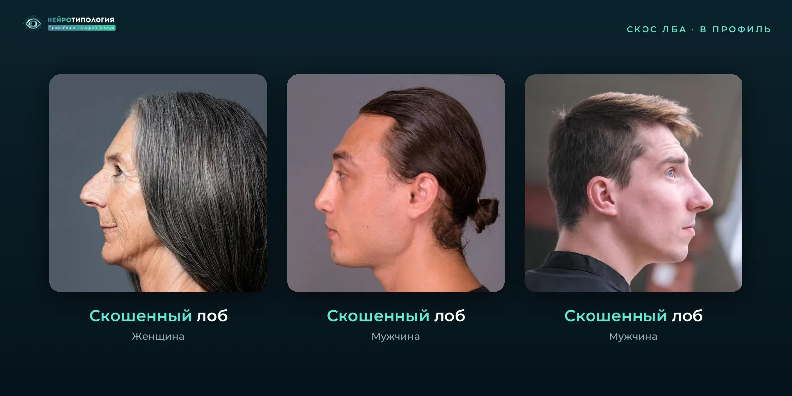 Скошенный лоб у разных людей, фото в профиль