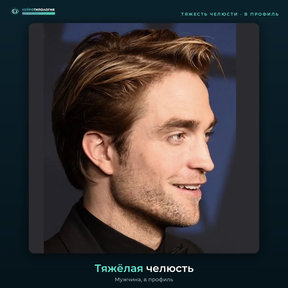Тяжёлая челюсть, фото в профиль Тяжёлая челюсть, фото в профиль