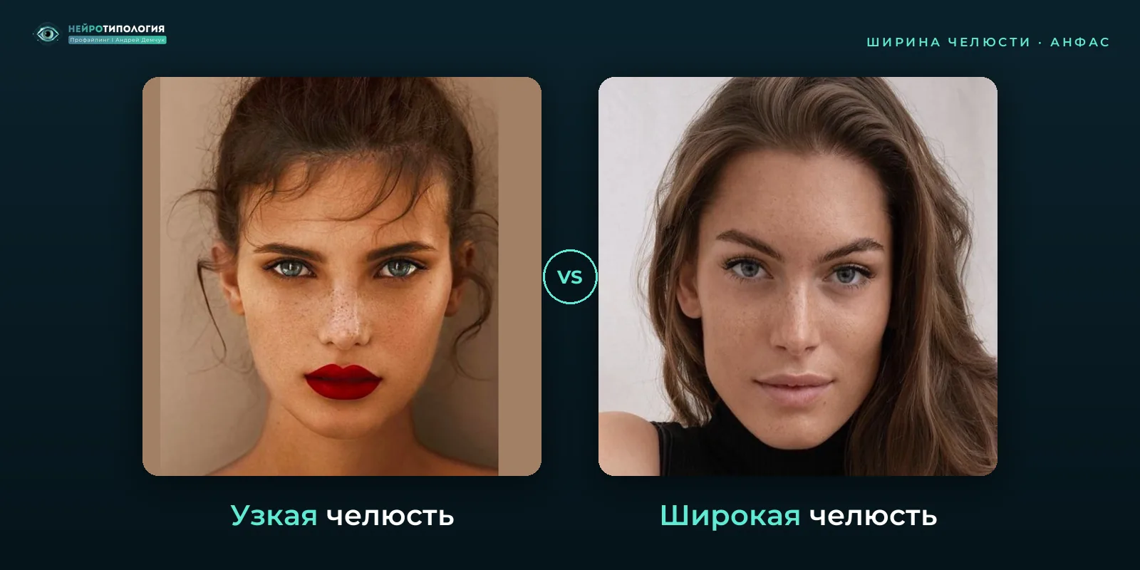 Узкая челюсть и широкая челюсть: сравнение, фото анфас Узкая челюсть и широкая челюсть: сравнение, фото анфас